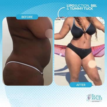 Slider image (9) Dra. Silvia Aviles